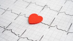 FDA 批准了 Caristo 的 AI 驱动的 CAD 诊断软件