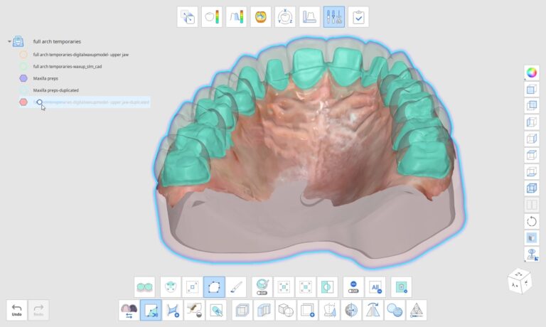 CAD-Ray 和 Zylo3D 合作：为牙科专业人士提供经济实惠的无缝 3D 打印解决方案