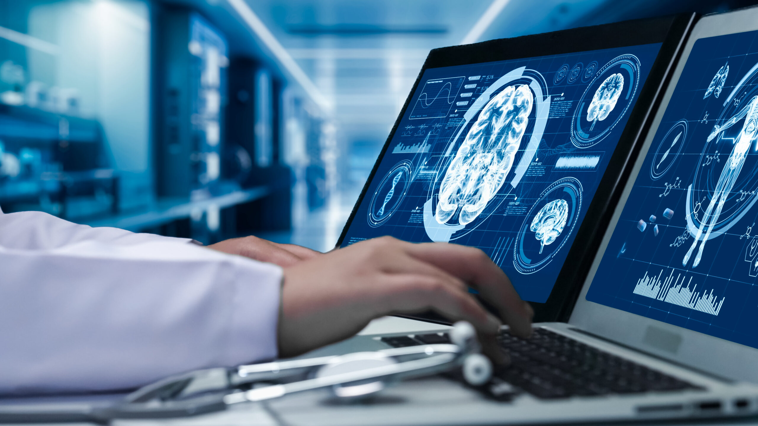 澳大利亚制造的 AI 模型旨在提高癫痫发作检测能力