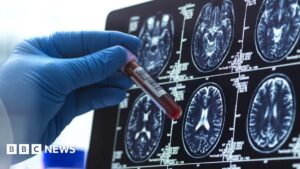 该公司的软件错误使 NHS 数据“容易受到黑客攻击”