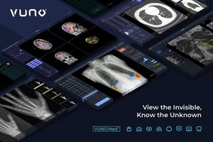 VUNO 的新 AI 模型在 ICU 再入院预测方面优于传统方法