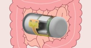 这款可摄入的智能胶囊可以无线实时监测肠道健康状况