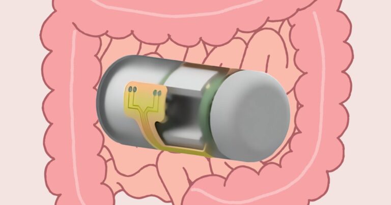 这款可摄入的智能胶囊可以无线实时监测肠道健康状况