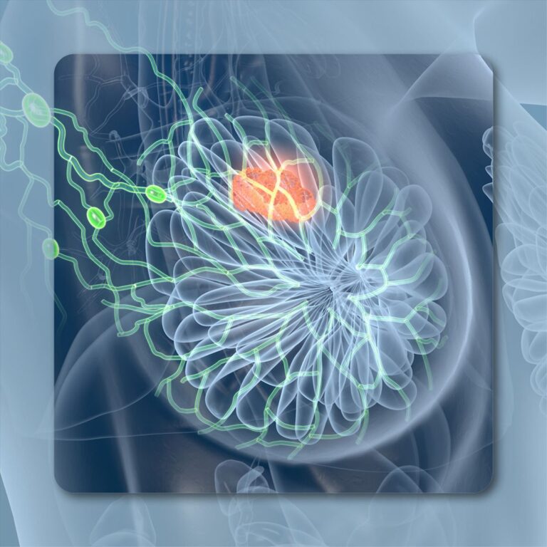 一线 Palbociclib 组合改善来自弱势地区的真实世界 HR+/HER2 阴性乳腺癌人群的预后