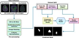Dsit UNet，一种基于双流迭代转换器的 UNet 架构，用于从 flair MRI 图像中分割脑肿瘤