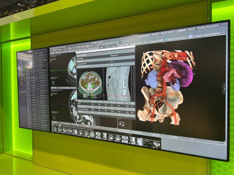 Visage AI 加速器受到 UCSF 合作伙伴关系的推动