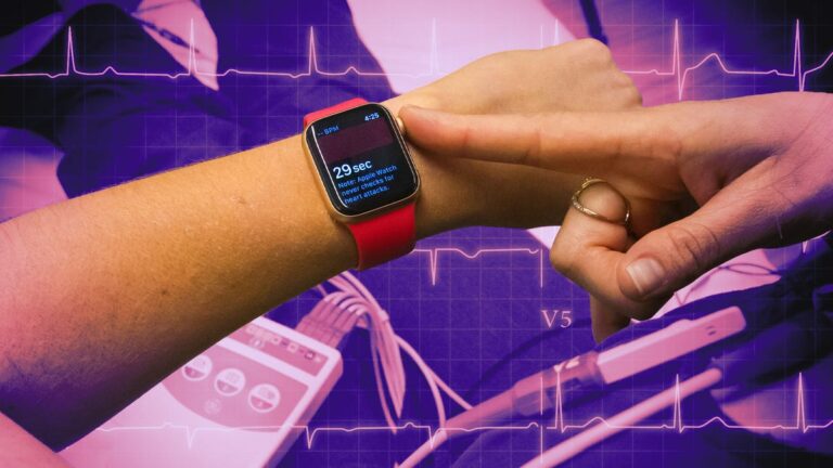 10 年后的 Apple Watch:改变我一切的功能