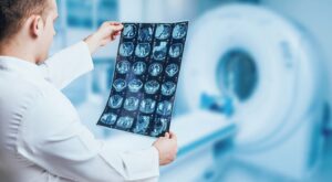 UCL 研究人员开发用于多发性硬化症评估的 AI 工具