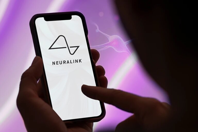 Neuralink 脑植入物让 ALS 患者再次说话