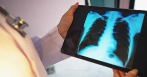 Viz.ai 与 Regeneron、Sanofi 合作研究 COPD 工具