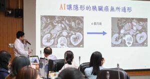 台大医院全面部署胰脏癌影像 AI