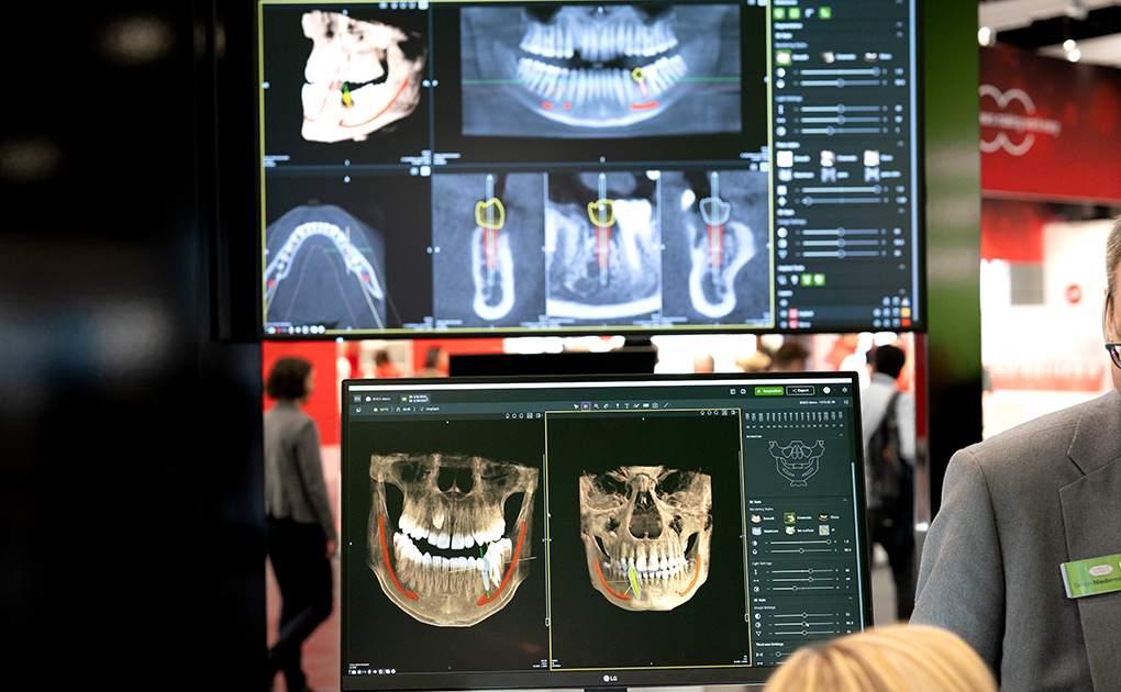 AI 之眼塑造牙科成像的未来