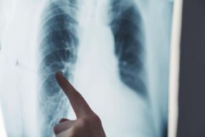 使用 57m 人的 NHS 数据进行训练的 AI 模型“可以预测疾病”