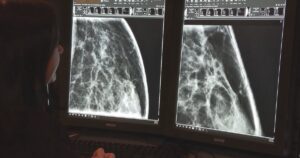 眼神交流和早期诊断：AI 如何改变 BC 省的一线医疗保健