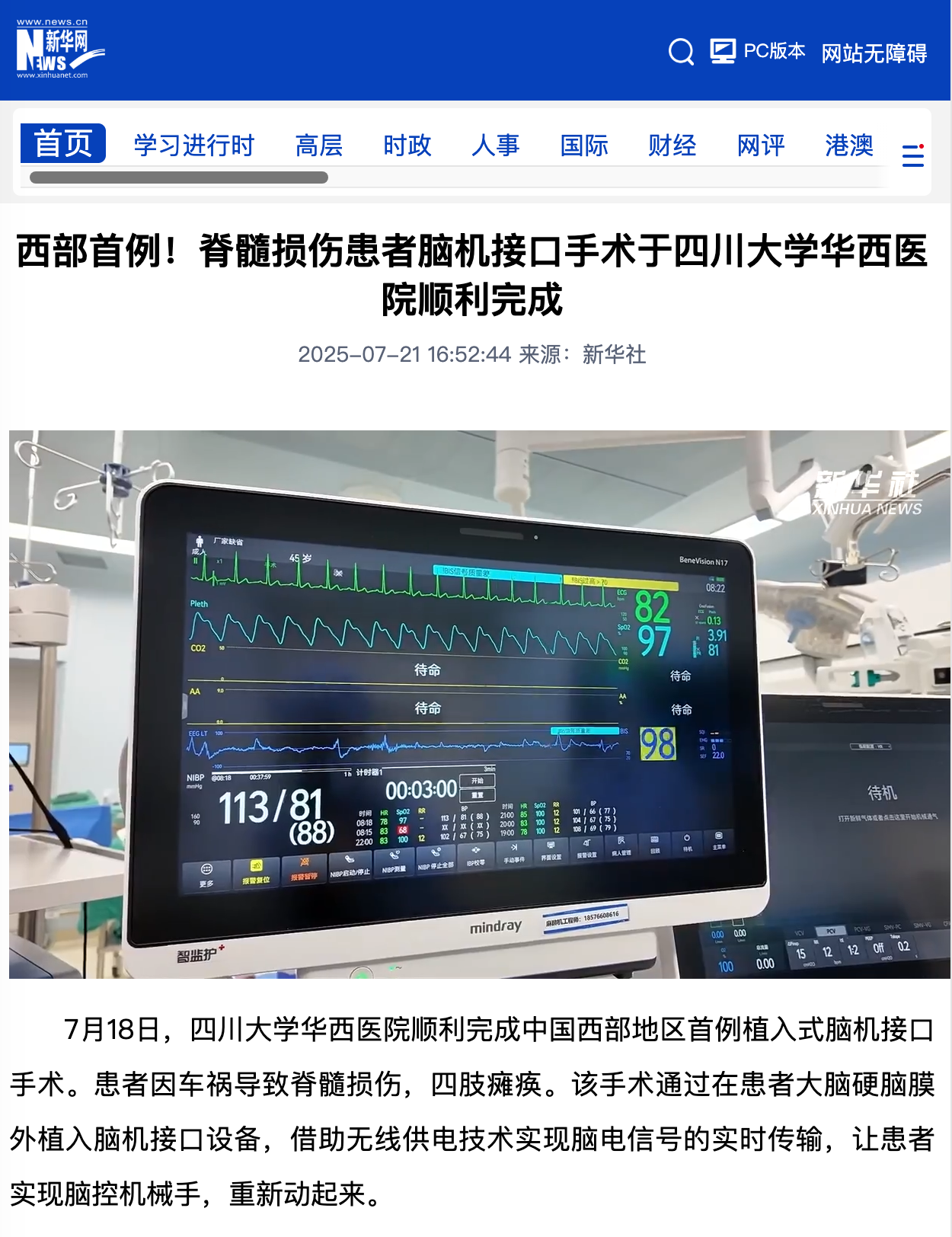 四川大学华西医院完成首例脊髓损伤患者脑机接口手术