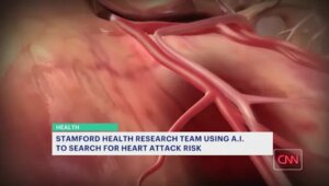 Stamford Health 研究人员使用 AI 来确定一个人心脏病发作的风险