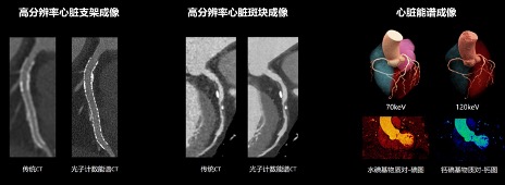 国产光子CT已入驻上海2家医院：高分辨率成像，可拍“彩色照片”
