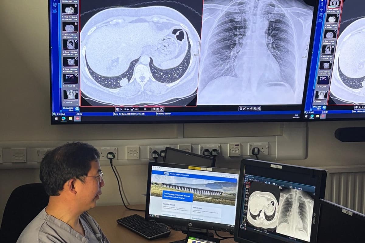 AI助力NHS早期发现健康问题