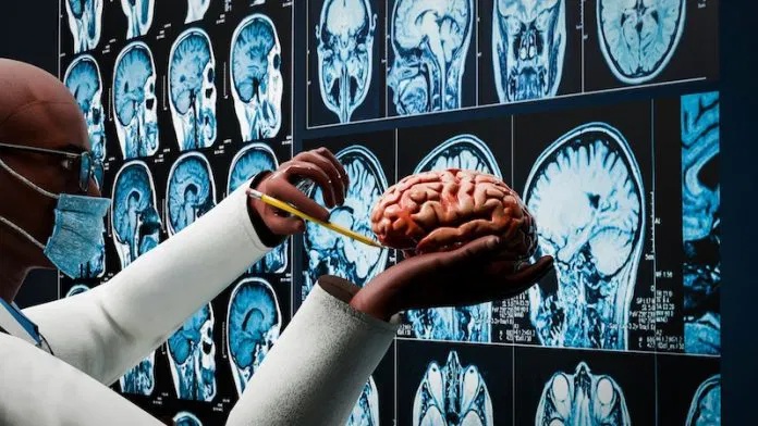 新AI工具快速检测中风和脑癌